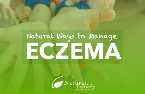 5 Natural Ways to Manage Eczema