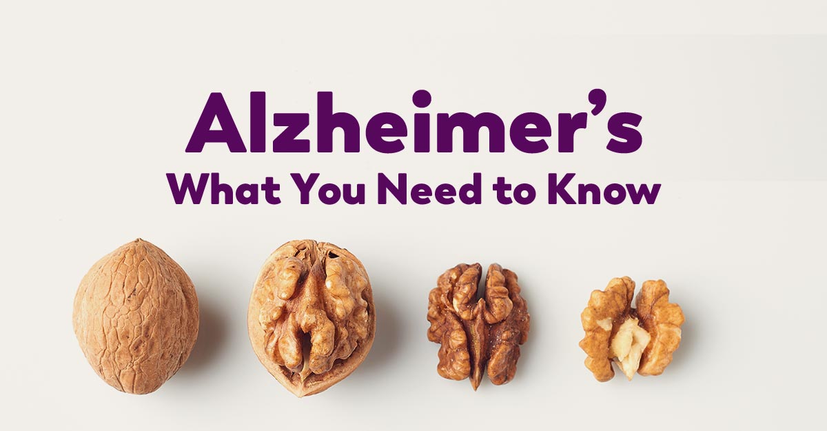 Alzheimer's playbook