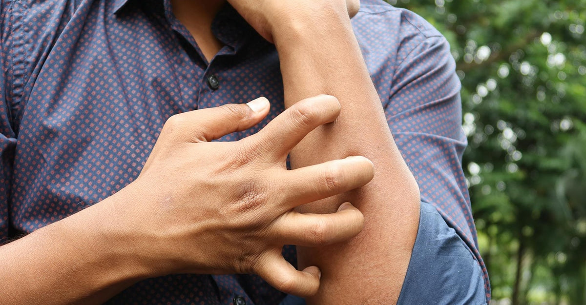 home remedies for itchy skin