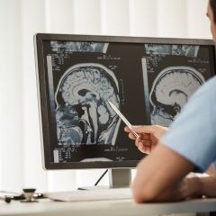 Dr. Sherry Rogers: Drugs That Damage the Brain