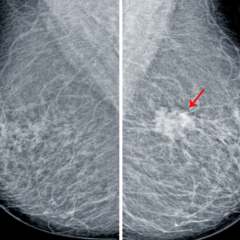 Dr. Sherry Rogers: How to Manage Calcification