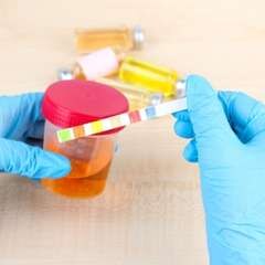 The Link Between Uric Acid Levels and Gout